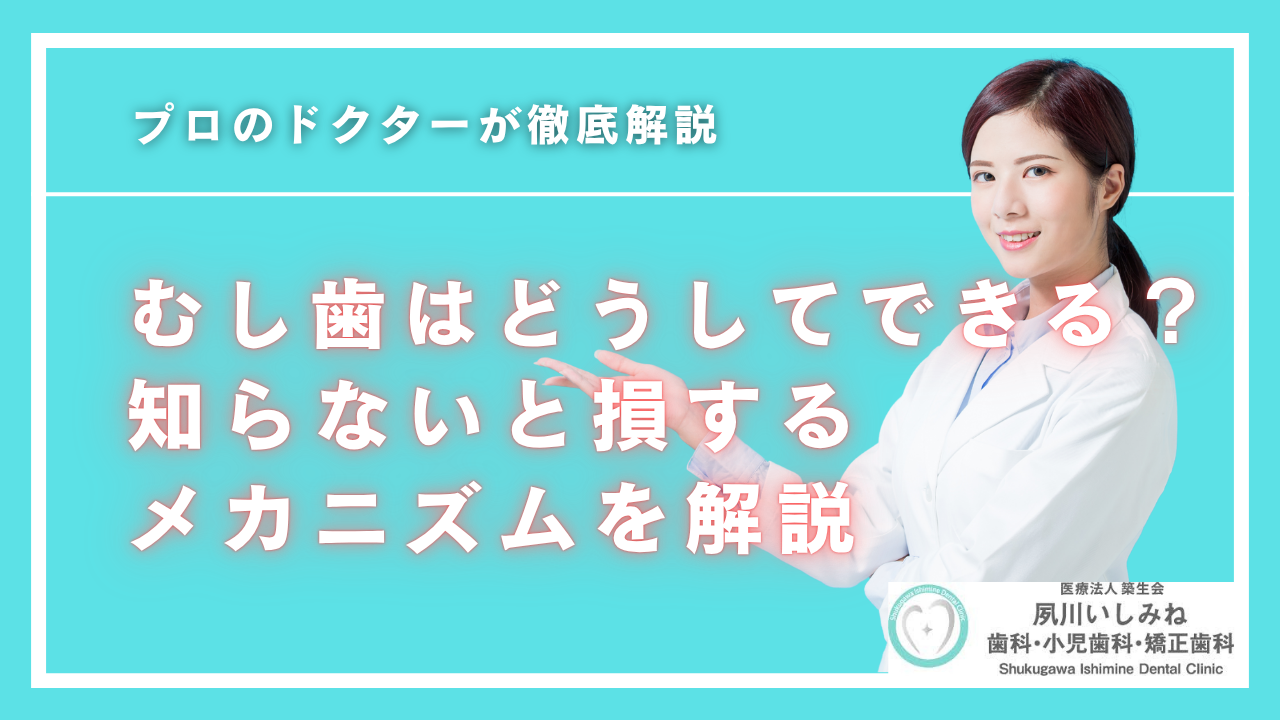 むし歯はどうしてできる？知らないと損するメカニズムを解説
