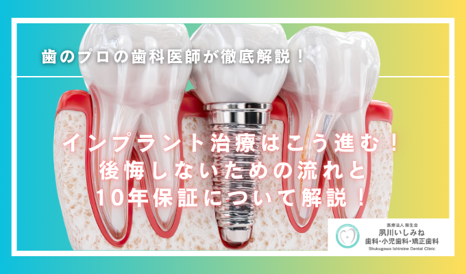 インプラント治療はこう進む!後悔しないための流れと10年保証について解説!