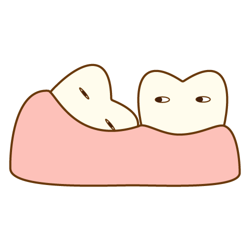 親知らずについて