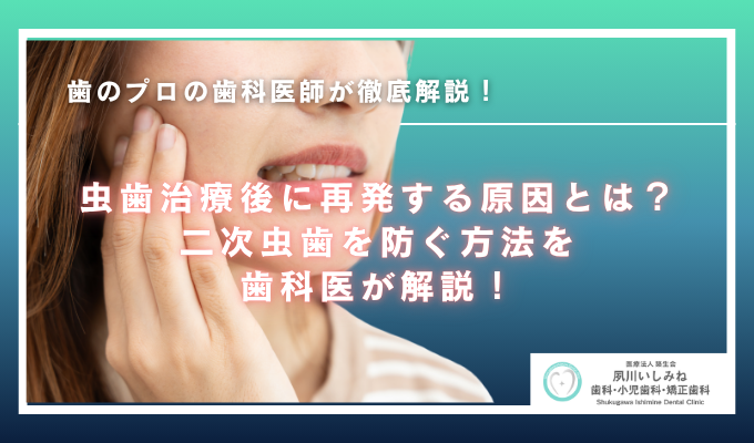 虫歯治療後に再発する原因とは？二次虫歯を防ぐ方法を歯科医が解説！