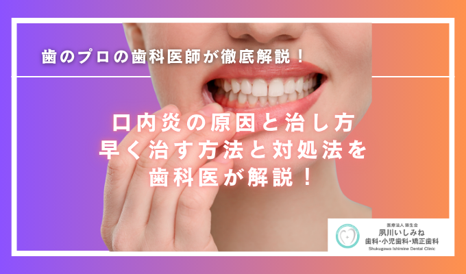 口内炎の原因と治し方｜早く治す方法とできる場所別の対処法を歯科医が解説！