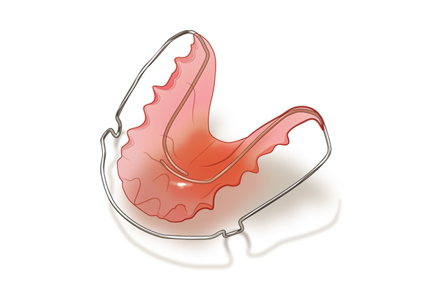 床矯正のイラスト