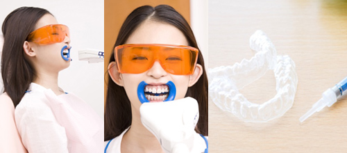 オフィスホワイトニングの様子とホームホワイトニングの道具