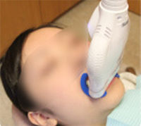 専用のライトを歯に当てる様子