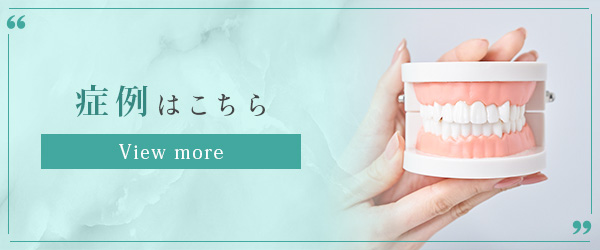 症例はこちら
