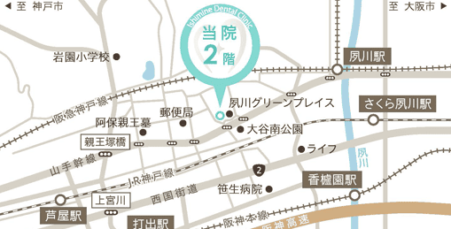 夙川いしみね歯科・小児歯科・矯正歯科のイラストマップ